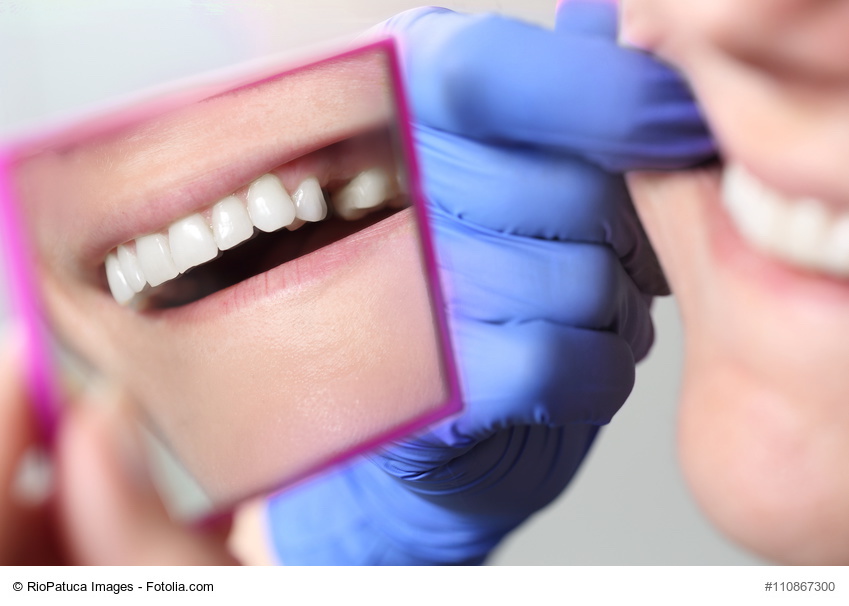Patientin mit Zahnluecke im Spiegel beim Zahnarzt