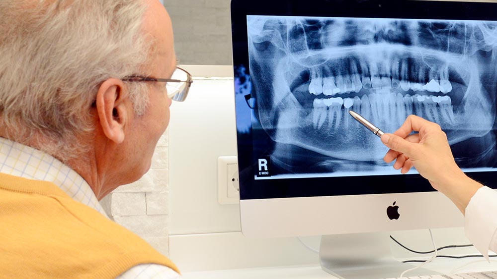 Zahnmedizinische Assistenz zeigt dem Patienten das Parodontitisrisiko
